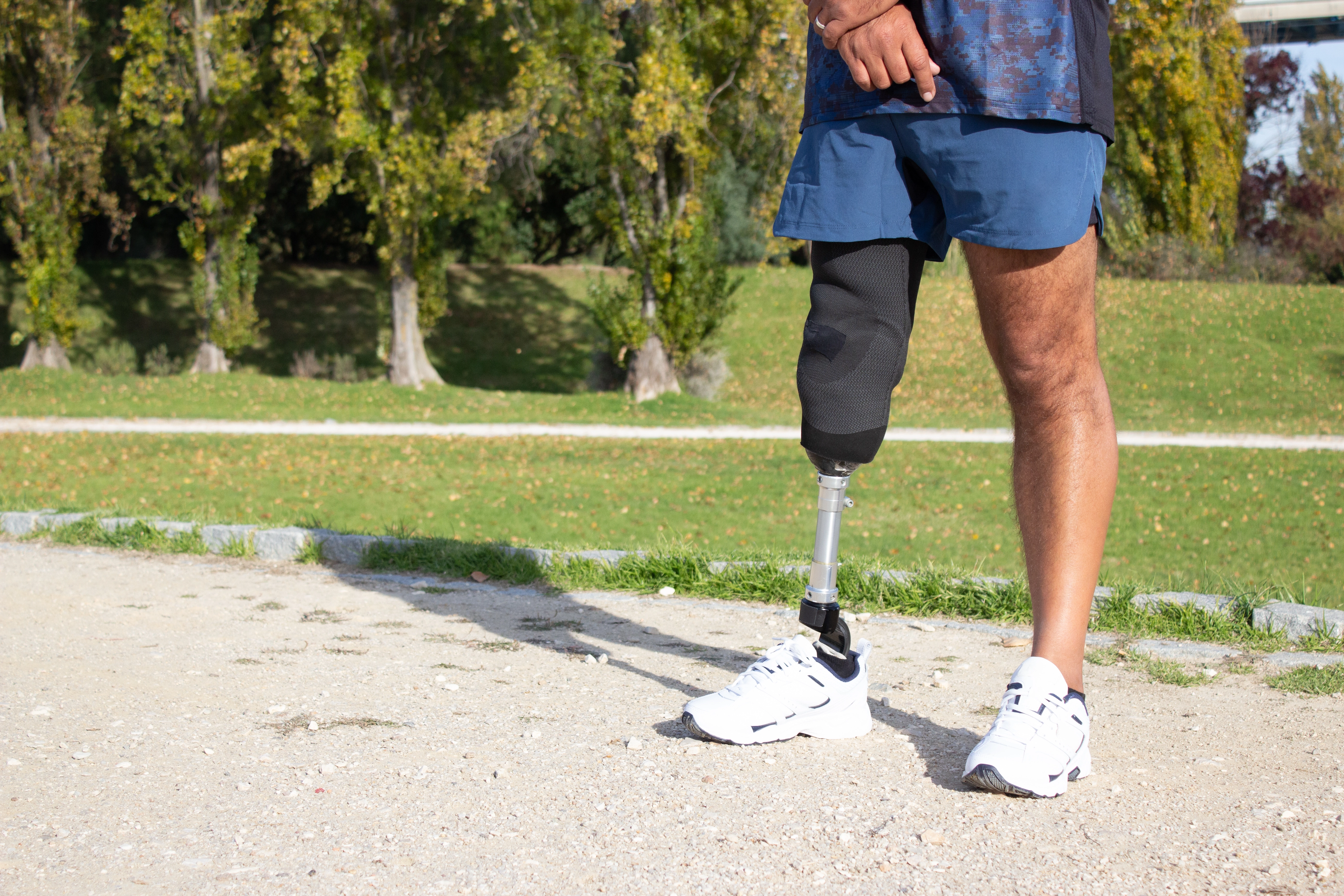 close-up-caucasian-man-with-mechanical-leg-sportsman-blue-shorts-white-sneakers-photographed-park-sp